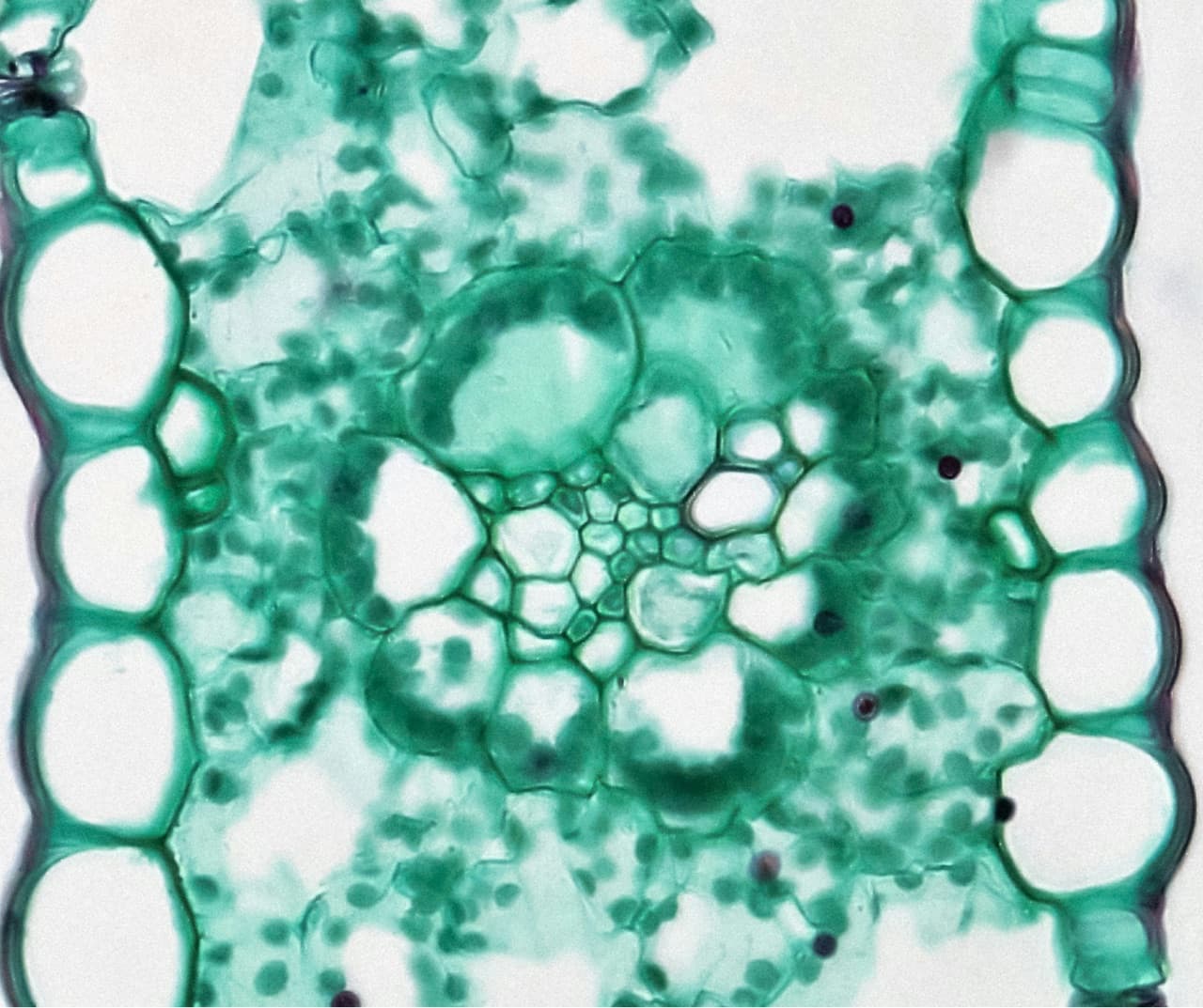 Plant cells under the microscope